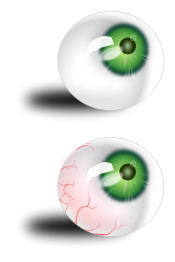 Eyeball green & bloodshot